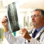 A Guide to Lumbosacral Spine X-Rays