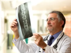 A Guide to Lumbosacral Spine X-Rays