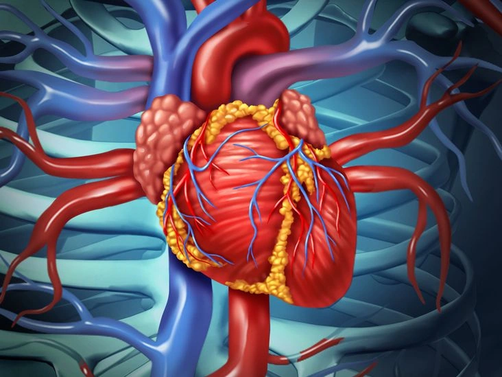 Understanding Open-Heart Surgery