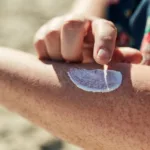 Advanced Basal Cell Carcinoma: Identification and Treatment