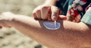 Advanced BCC Pictures: Identification & Treatment