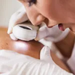 What Does Melanoma Look Like (With Pictures)