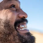 How Does a Gold Crown Stack Up to Porcelain?