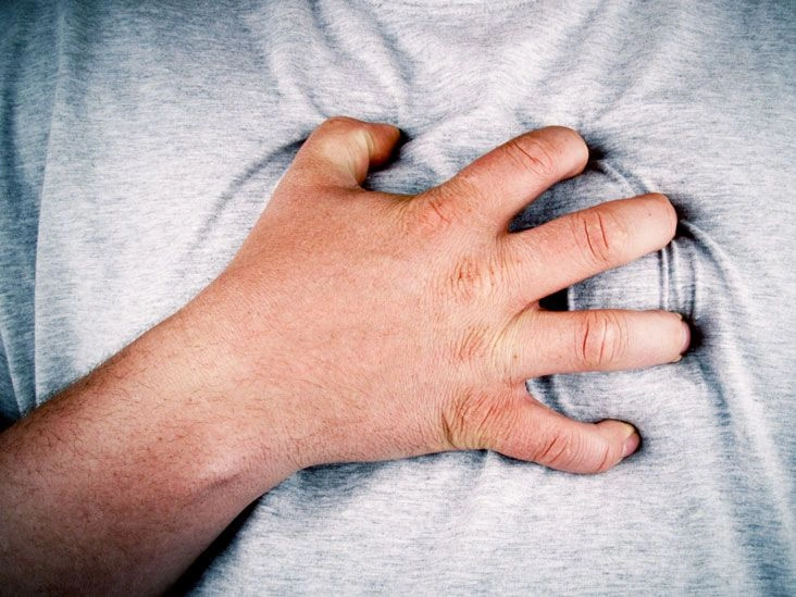 Seizures vs. Seizure Disorders