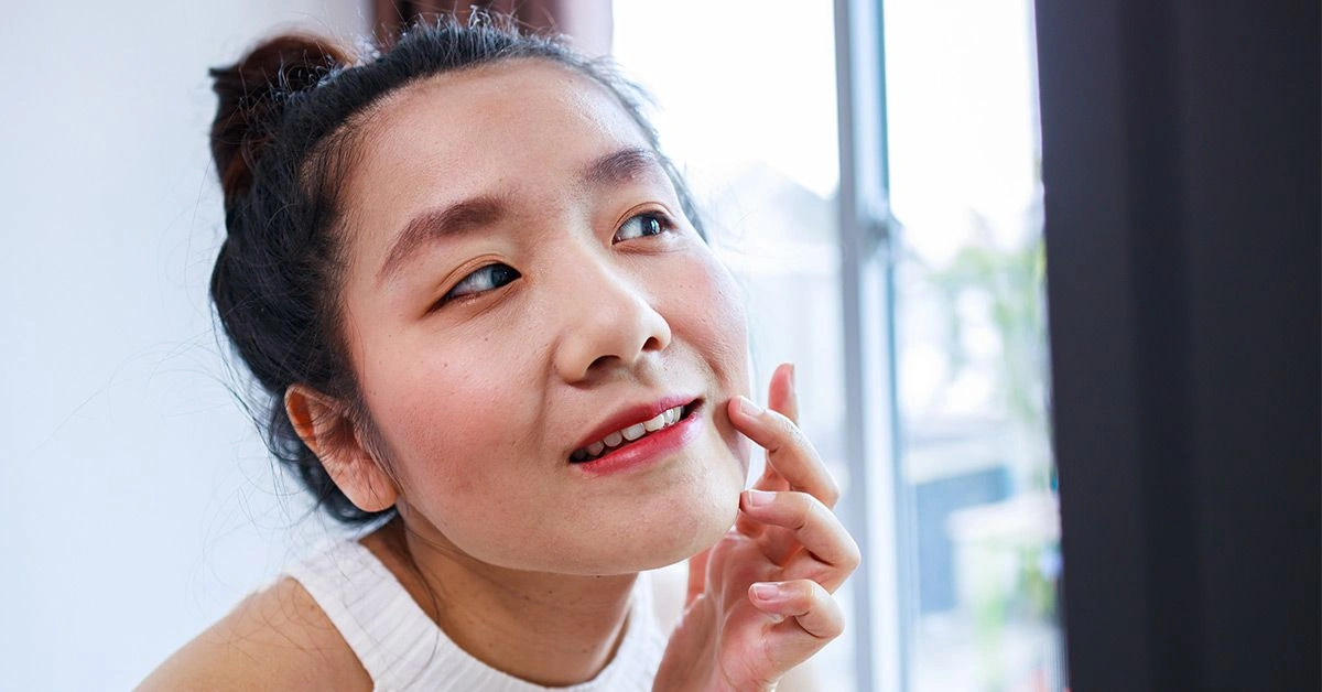 What Is Angular Cheilitis?