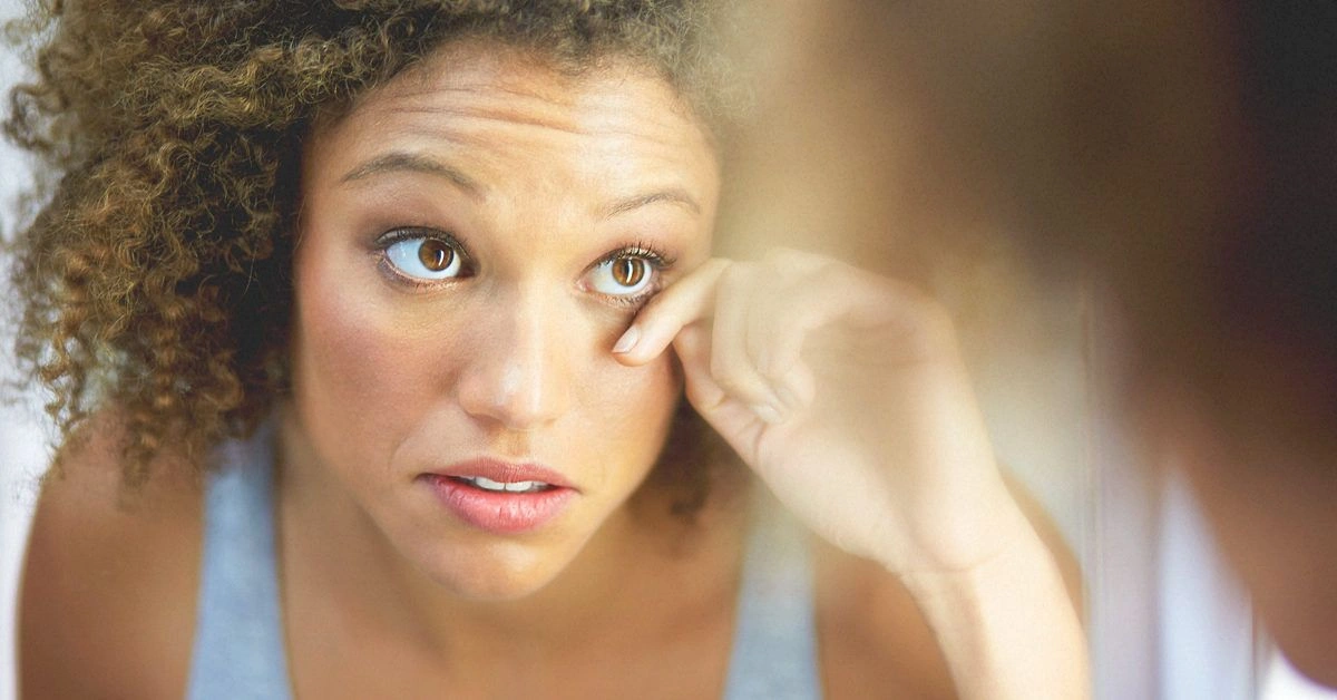 What Causes Dark Eyelids and How Are They Treated?